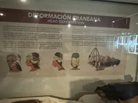 Artificial Cranial Deformation in Ancient Peru
