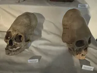 Deformed Skulls of Paracas Culture