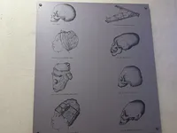 Cranial Modification Practices